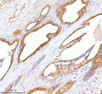 TNIK Rabbit Polyclonal Antibody