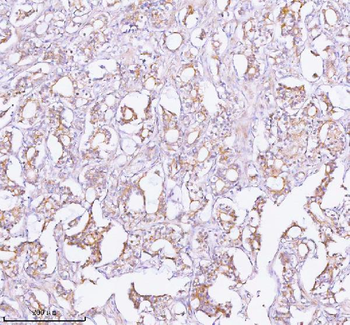 TNIK Rabbit Polyclonal Antibody