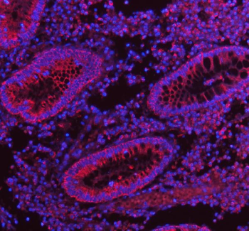 HERP/HERPUD1 Rabbit Polyclonal Antibody