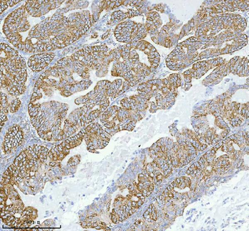 HERP/HERPUD1 Rabbit Polyclonal Antibody