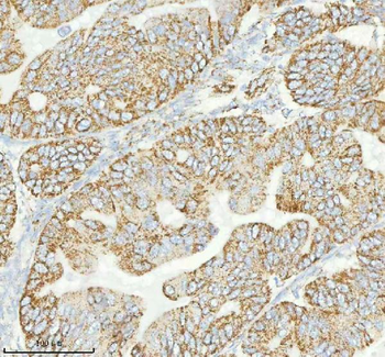 HERP/HERPUD1 Rabbit Polyclonal Antibody