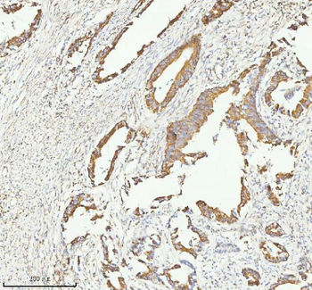HERP/HERPUD1 Rabbit Polyclonal Antibody