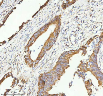 HERP/HERPUD1 Rabbit Polyclonal Antibody