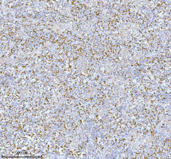 HERP/HERPUD1 Rabbit Polyclonal Antibody