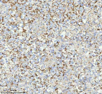 HERP/HERPUD1 Rabbit Polyclonal Antibody