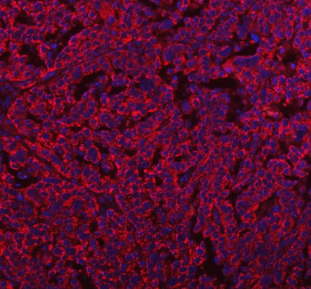 HERP/HERPUD1 Rabbit Polyclonal Antibody