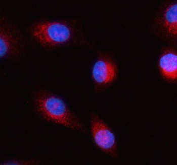 HERP/HERPUD1 Rabbit Polyclonal Antibody