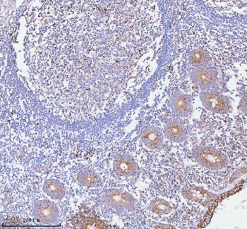 HERP/HERPUD1 Rabbit Polyclonal Antibody