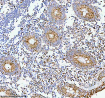 HERP/HERPUD1 Rabbit Polyclonal Antibody
