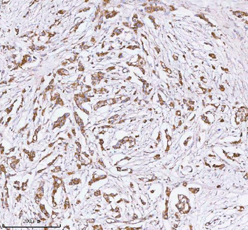 HERP/HERPUD1 Rabbit Polyclonal Antibody