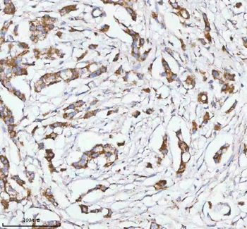 HERP/HERPUD1 Rabbit Polyclonal Antibody