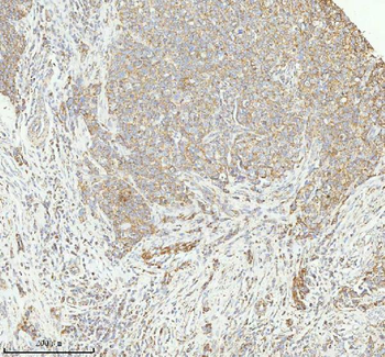 HERP/HERPUD1 Rabbit Polyclonal Antibody