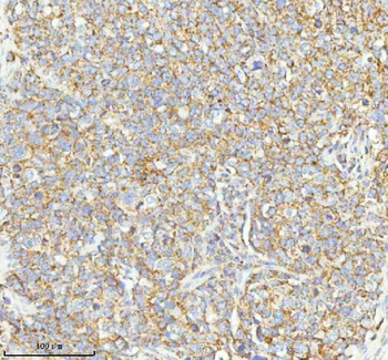 HERP/HERPUD1 Rabbit Polyclonal Antibody