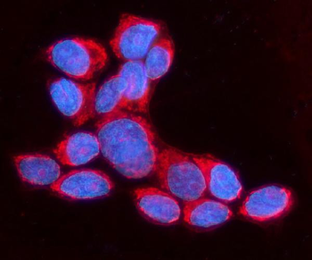 APC1/ANAPC1 Rabbit Polyclonal Antibody
