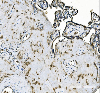 APC1/ANAPC1 Rabbit Polyclonal Antibody