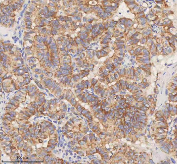 STIM1 Rabbit Polyclonal Antibody