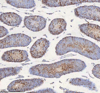 STIM1 Rabbit Polyclonal Antibody