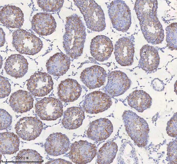 STIM1 Rabbit Polyclonal Antibody