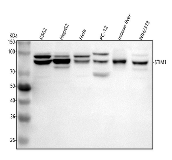STIM1 Rabbit Polyclonal Antibody