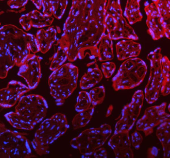 STIM1 Rabbit Polyclonal Antibody