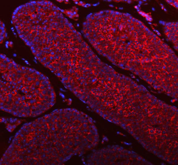 STIM1 Rabbit Polyclonal Antibody