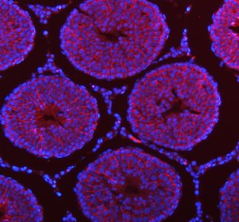 STIM1 Rabbit Polyclonal Antibody