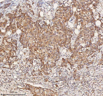 STIM1 Rabbit Polyclonal Antibody