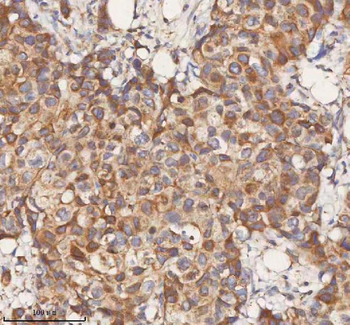 STIM1 Rabbit Polyclonal Antibody