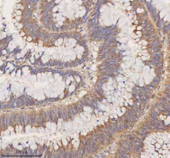 STIM1 Rabbit Polyclonal Antibody