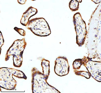 STIM1 Rabbit Polyclonal Antibody
