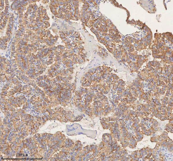 STIM1 Rabbit Polyclonal Antibody