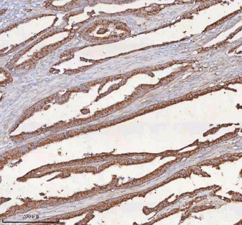 SLC6A20 Rabbit Polyclonal Antibody