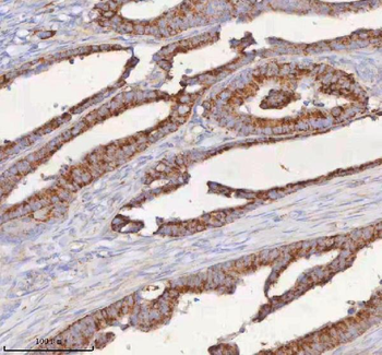 SLC6A20 Rabbit Polyclonal Antibody