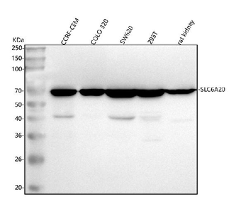 SLC6A20 Rabbit Polyclonal Antibody