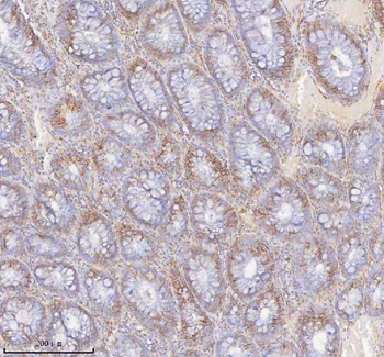 SLC6A20 Rabbit Polyclonal Antibody
