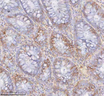SLC6A20 Rabbit Polyclonal Antibody