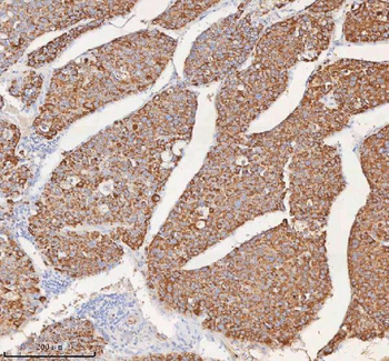 SLC6A20 Rabbit Polyclonal Antibody