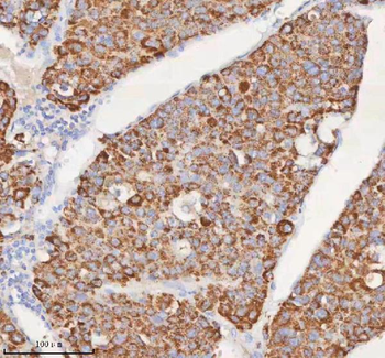 SLC6A20 Rabbit Polyclonal Antibody