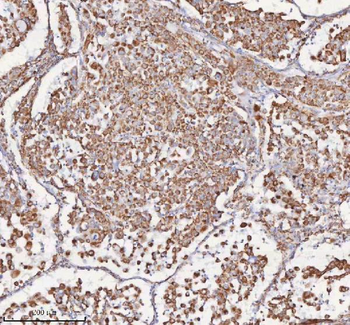 SLC6A20 Rabbit Polyclonal Antibody