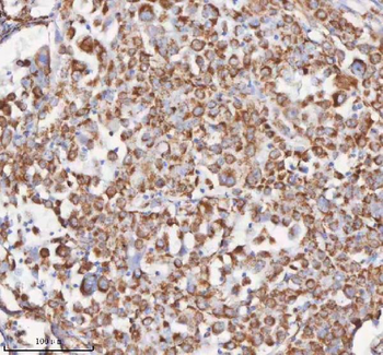 SLC6A20 Rabbit Polyclonal Antibody