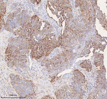 SLC6A20 Rabbit Polyclonal Antibody