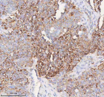 SLC6A20 Rabbit Polyclonal Antibody
