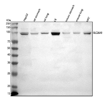 SLC26A9 Rabbit Polyclonal Antibody