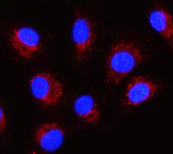 SERPINB8 Rabbit Polyclonal Antibody