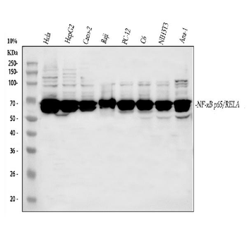 NF-κB p6/RELA/NF Rabbit Polyclonal Antibody