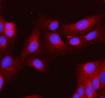 MLKL Rabbit Polyclonal Antibody