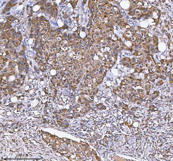 MLKL Rabbit Polyclonal Antibody