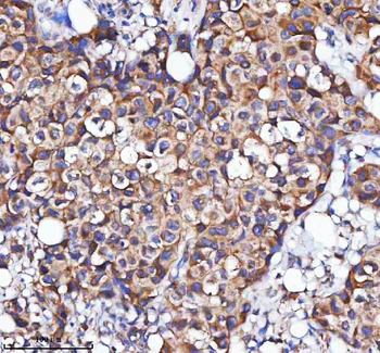 MLKL Rabbit Polyclonal Antibody