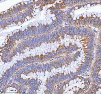 MLKL Rabbit Polyclonal Antibody