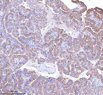 MLKL Rabbit Polyclonal Antibody